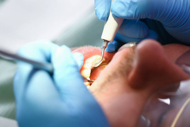 Best Urgent Dental Care for Toothache in Fort Stewart, GA