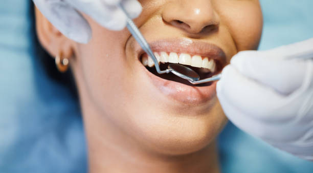 Best Emergency Dental Services for Seniors in Fort Stewart, GA